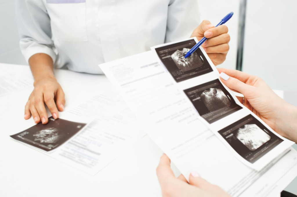 uterine polypectomy